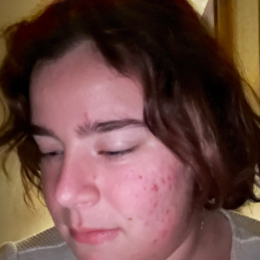 Orane profile