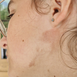 Bilou profile