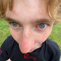Lucas profile